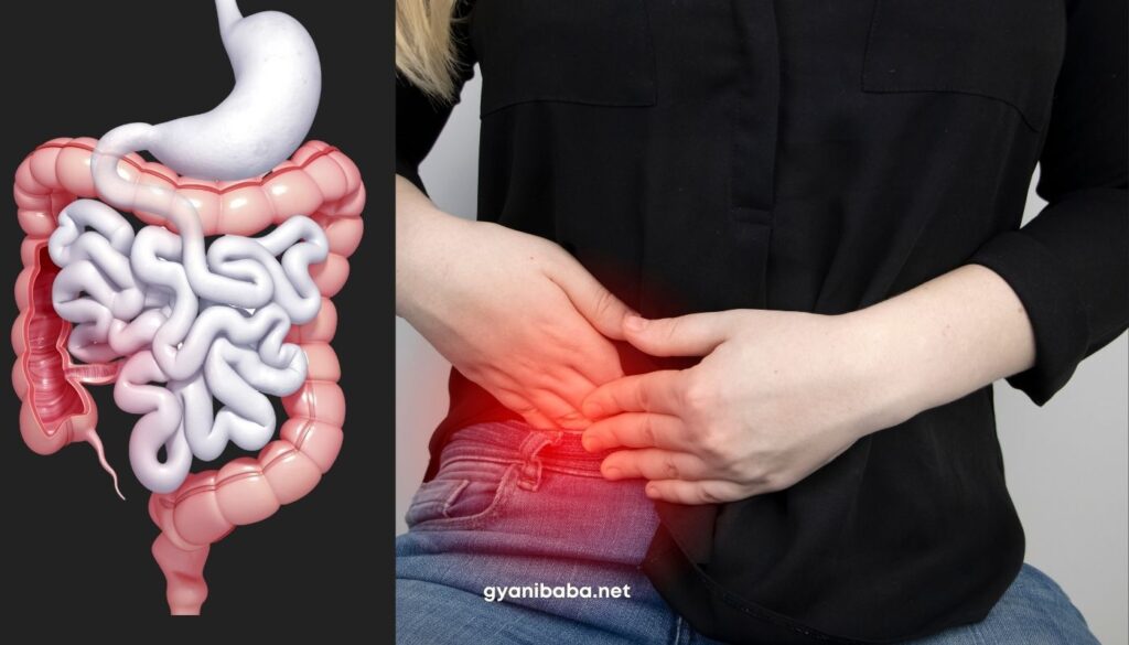 Appendix (अपेंडिक्स) नामक आंत के कारण होने वाले रोग-
