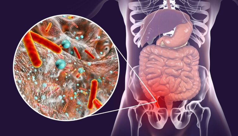 appendix-kiya-hota-hai